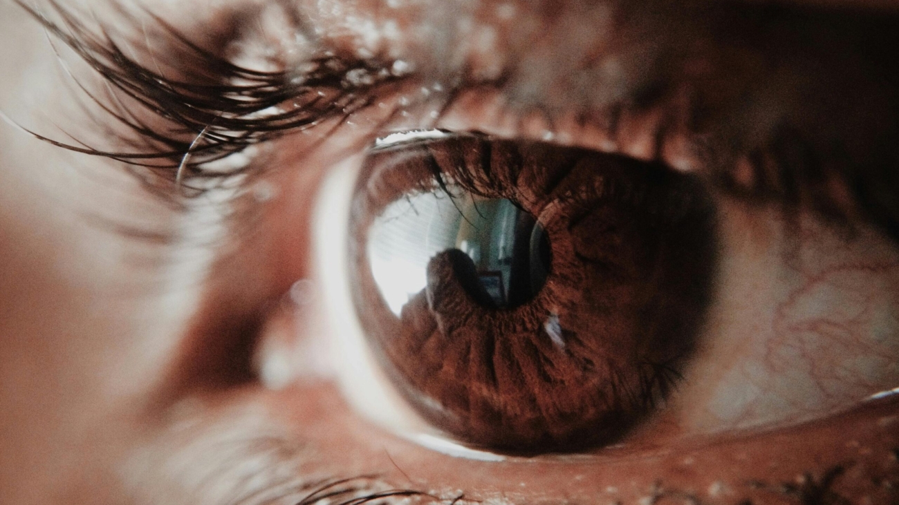 How to Prevent Cataracts Naturally